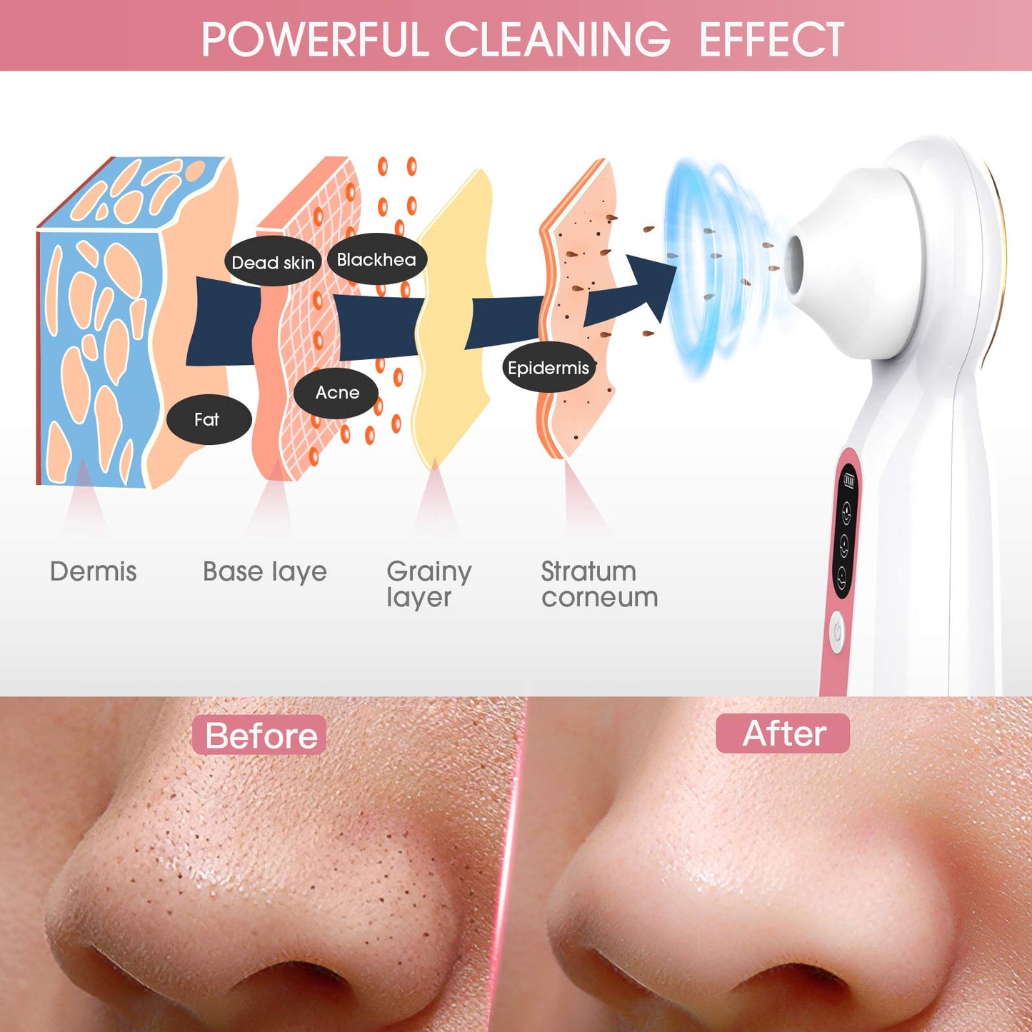 Pore Vacuum Face Clean/ Visible Blackhead Remover