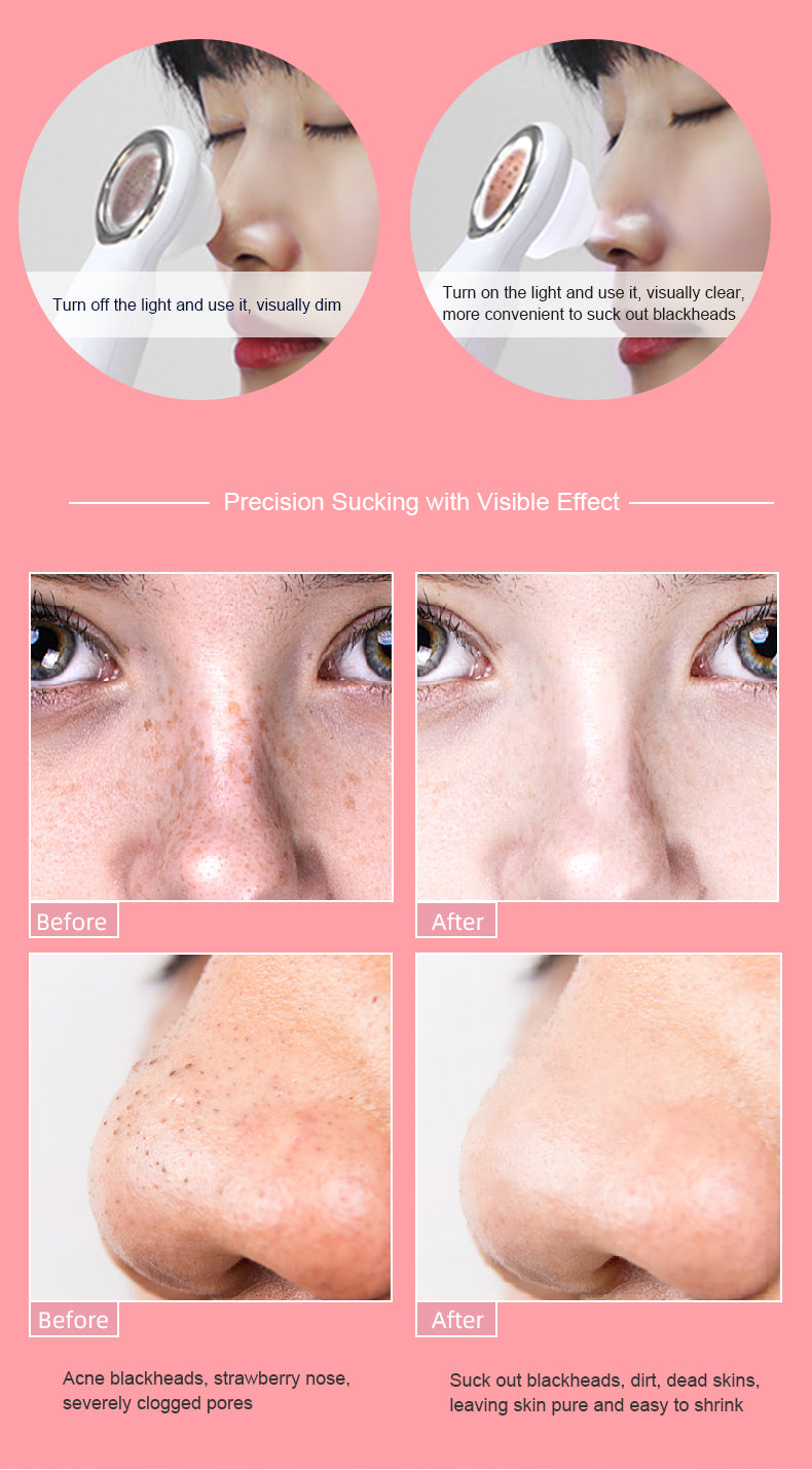 Pore Vacuum Face Clean/ Visible Blackhead Remover