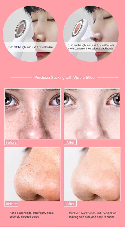 Pore Vacuum Face Clean/ Visible Blackhead Remover