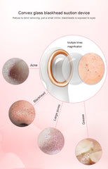 Pore Vacuum Face Clean/ Visible Blackhead Remover